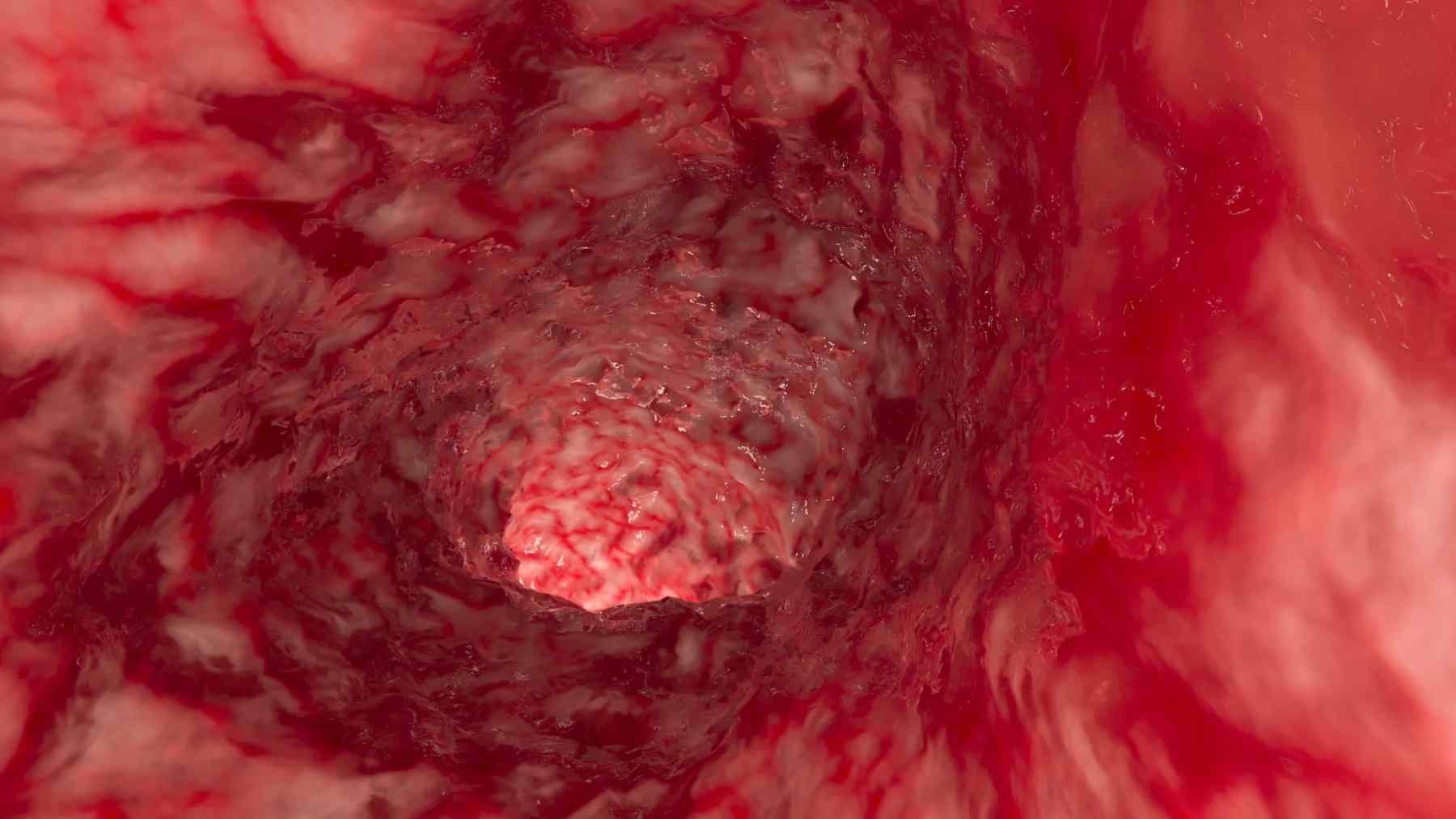 Images captured by cameras inside the arteries show how certain drugs “repair” the heart