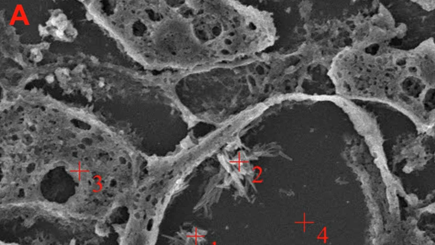 Electron microscope image showing polyethylene nanoplastic shards embedded in human brain tissue from a recent autopsy study.