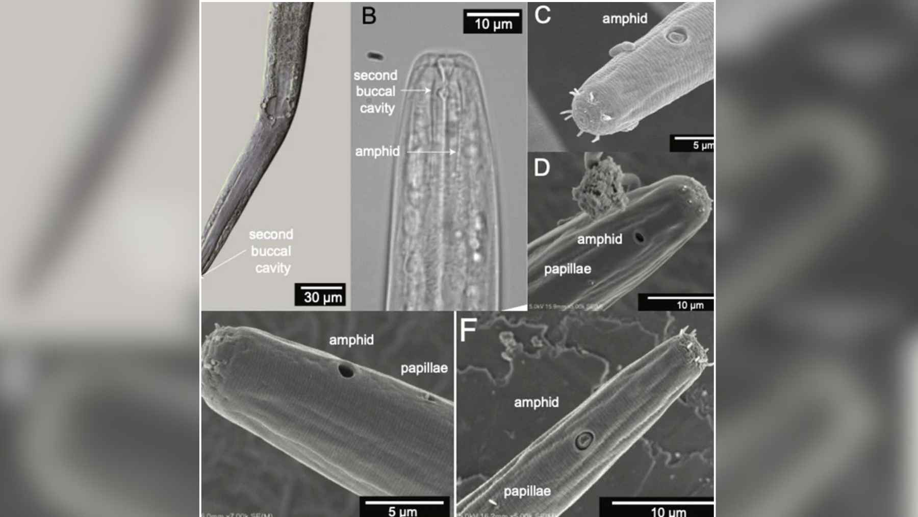 Microscope images of Diplolaimelloides woaabi, the newly identified worm species discovered in Utah’s Great Salt Lake