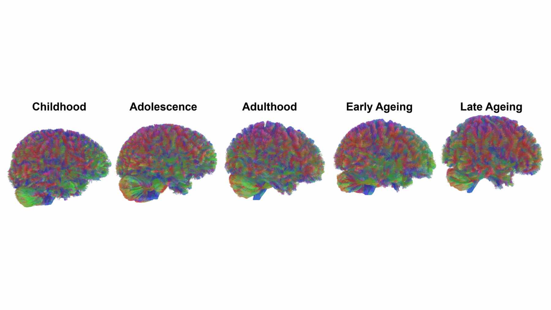 A colorful digital rendering of a human brain with glowing lines highlighting neural connections.