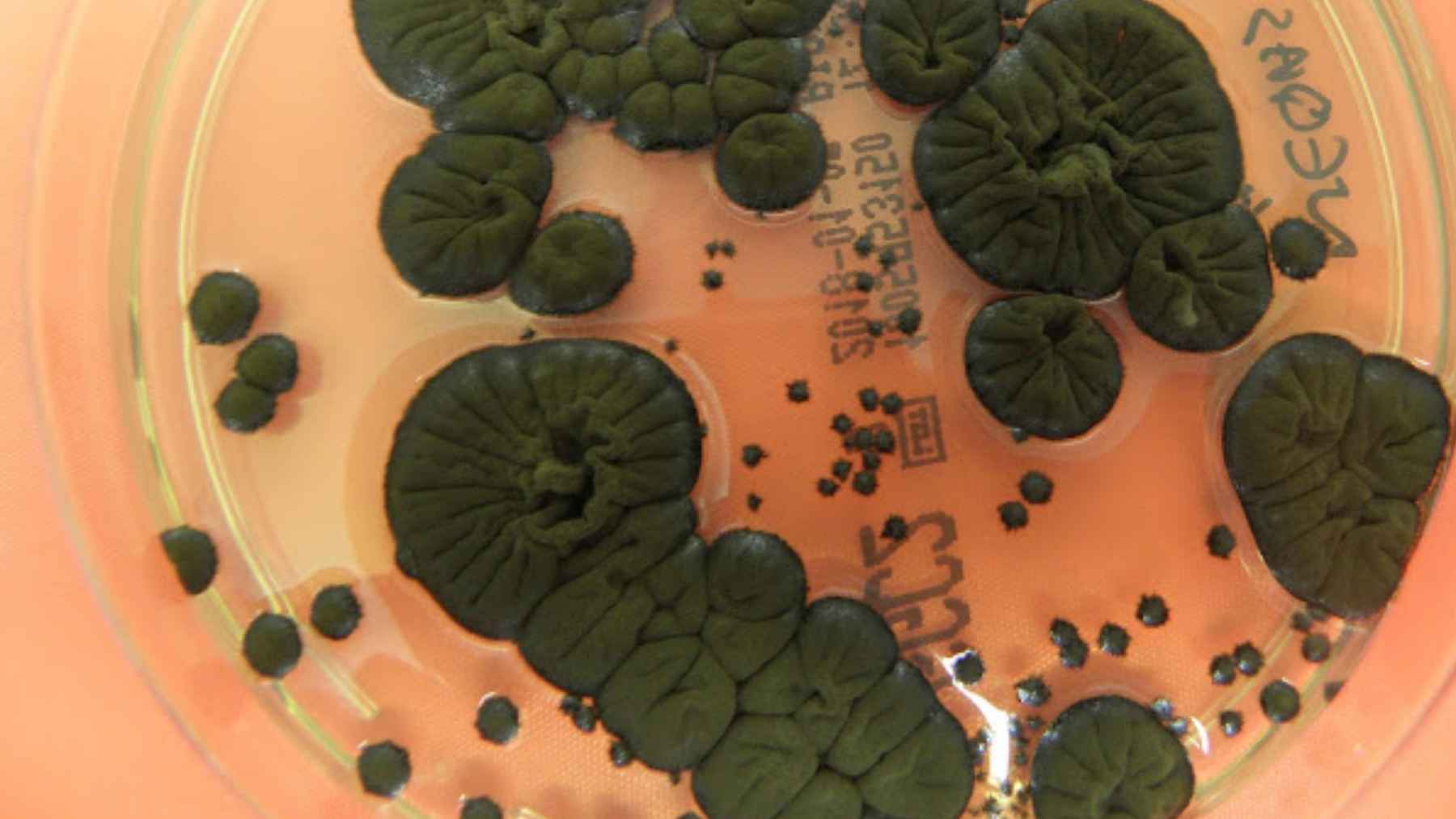 Dark green to black fungal colonies growing in a petri dish linked to radiation-resistant species from Chernobyl