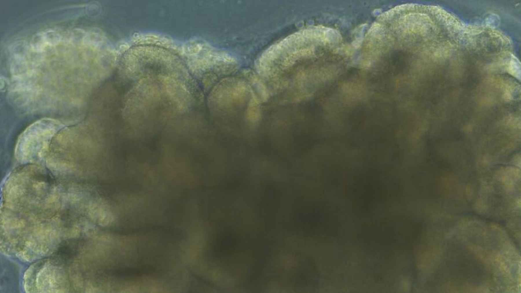 Lab-grown brain organoid on a chip used in an experiment testing learning and neural plasticity