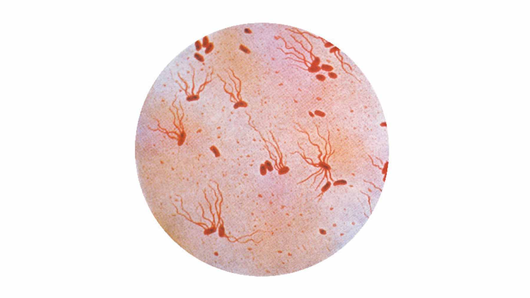 A laboratory technician holding a petri dish containing a culture of drug-resistant Salmonella Typhi bacteria.