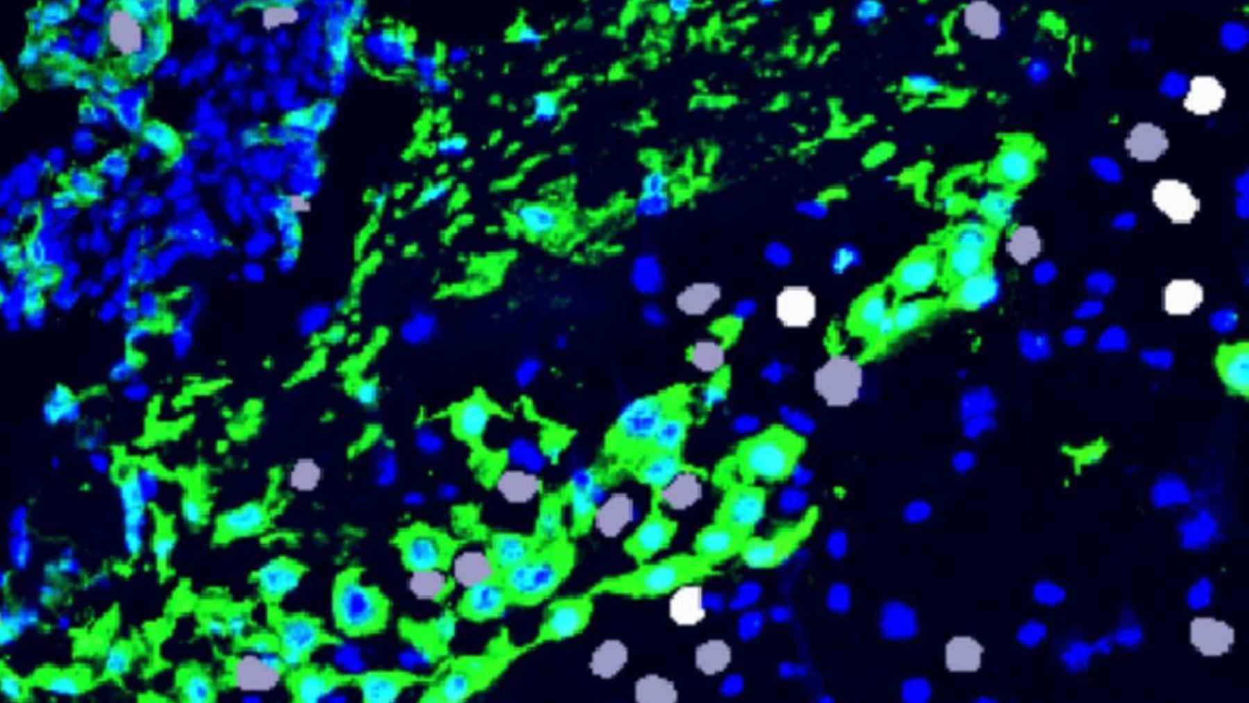 Scientists discover a new type of human cell that appears only at one moment in life, and no one yet knows exactly what it does 1 High-resolution microscope image of cells at the maternal-fetal interface in UCSF pregnancy research.