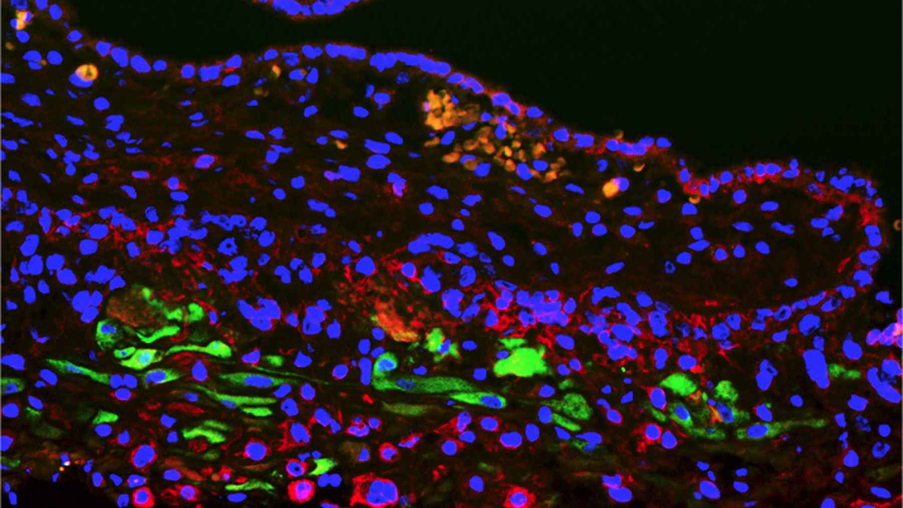Microscopic close-up of uterine and placental cells linked to a newly identified pregnancy cell type.