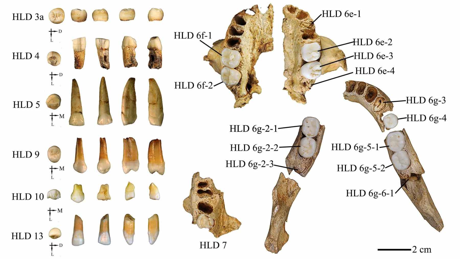 Homo erectus teeth dating back about 400,000 years, found in China, have just revealed an unexpected clue about a possible family connection to the mysterious Denisovans 2 A close-up microscopic view of fossilized Homo erectus teeth, showing the enamel structure analyzed by researchers to extract ancient protein sequences.