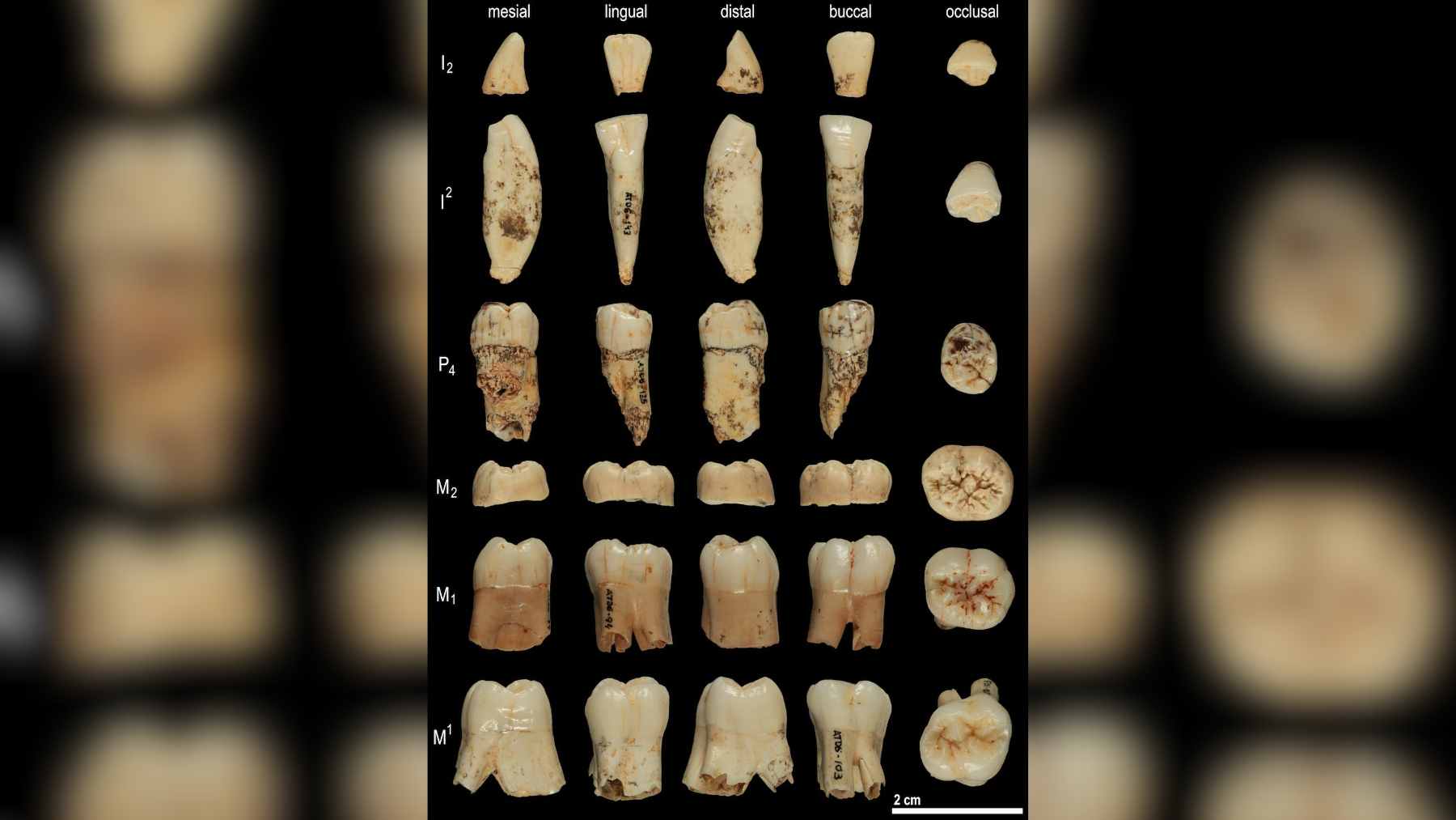 Close-up of fossilized mammalian dental calculus on a museum specimen, illustrating the mineralized layers that trap ancient oral microbes.
