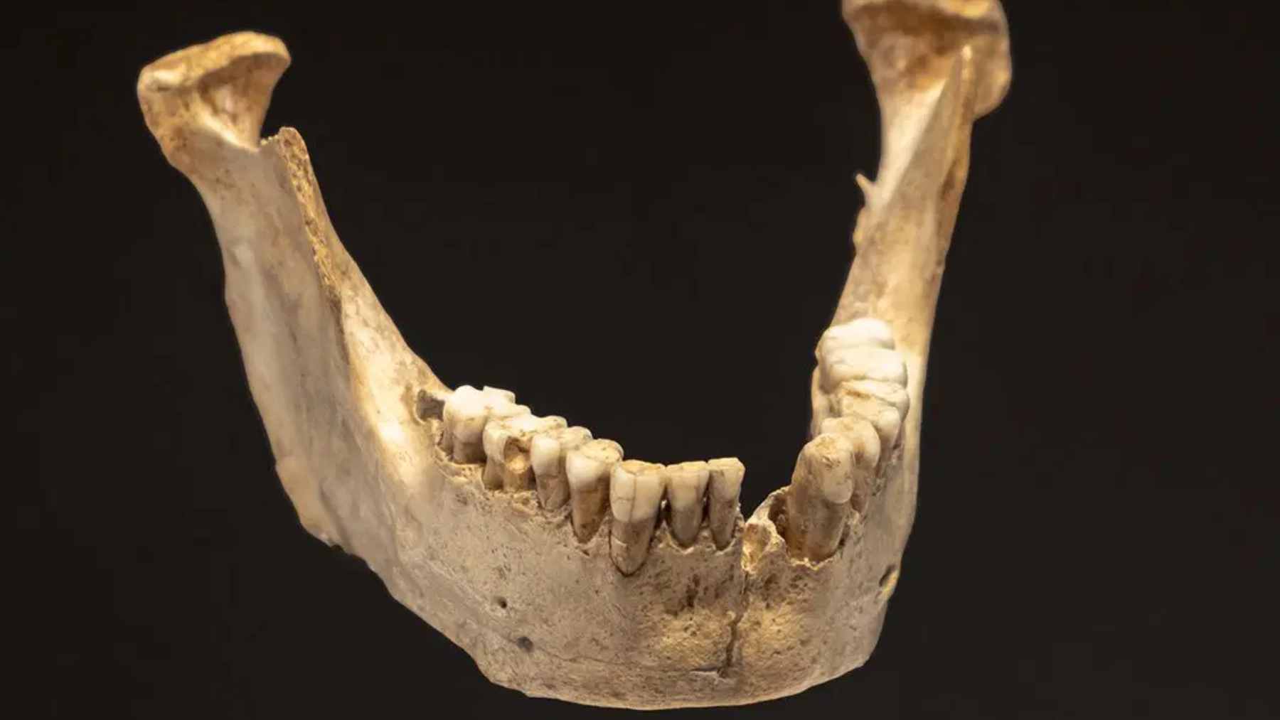 Close-up of fossilized mammalian dental calculus on a museum specimen, illustrating the mineralized layers that trap ancient oral microbes.