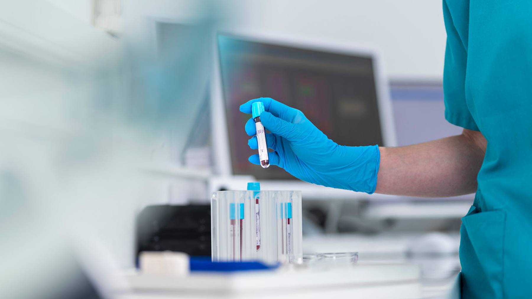 A lab technician holds a blood sample tube used to measure cholesterol levels.