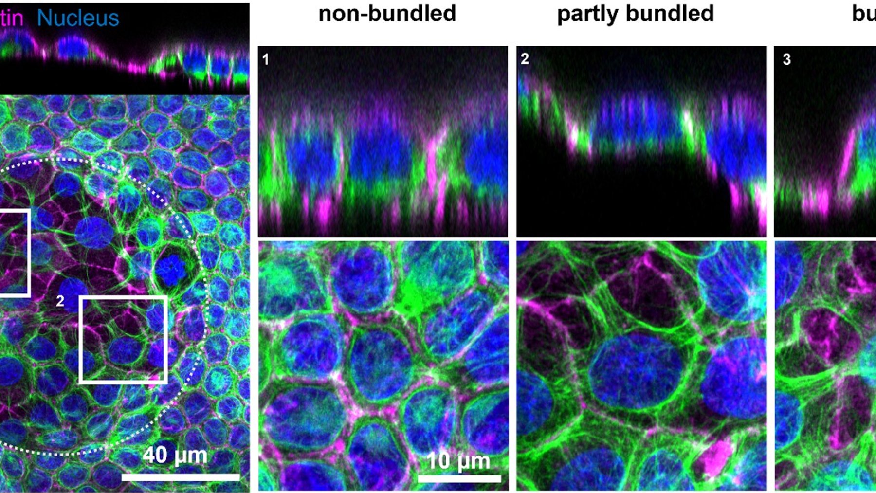 Microscopy images of epithelial tissue showing keratin networks and cell nuclei