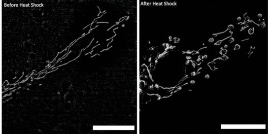 Two microscope images of mitochondria in Antarctic plunderfish cells, long and thread-like before warming and rounded and fragmented after one hour at room temperature