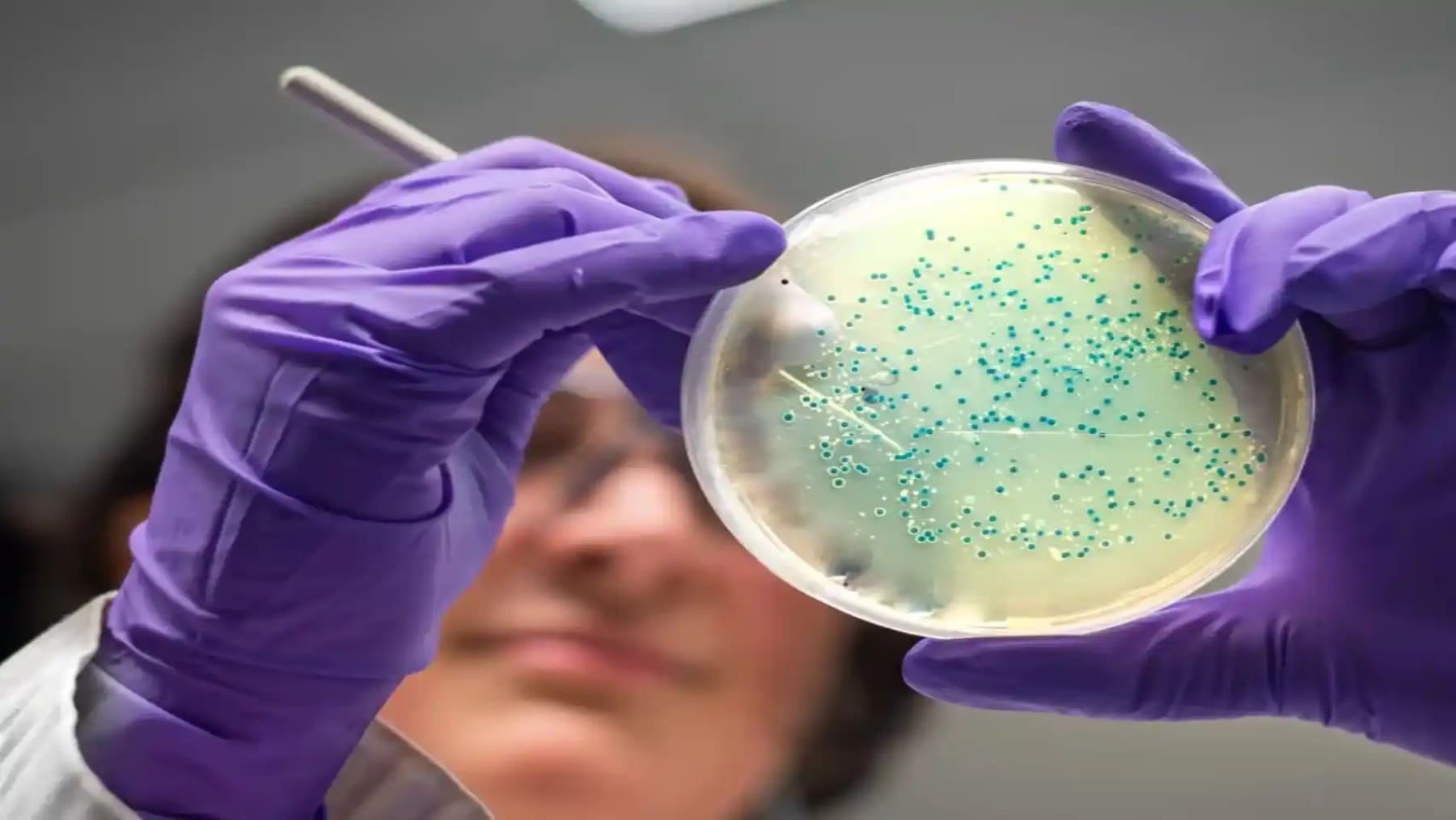 Reino Unido bacterias