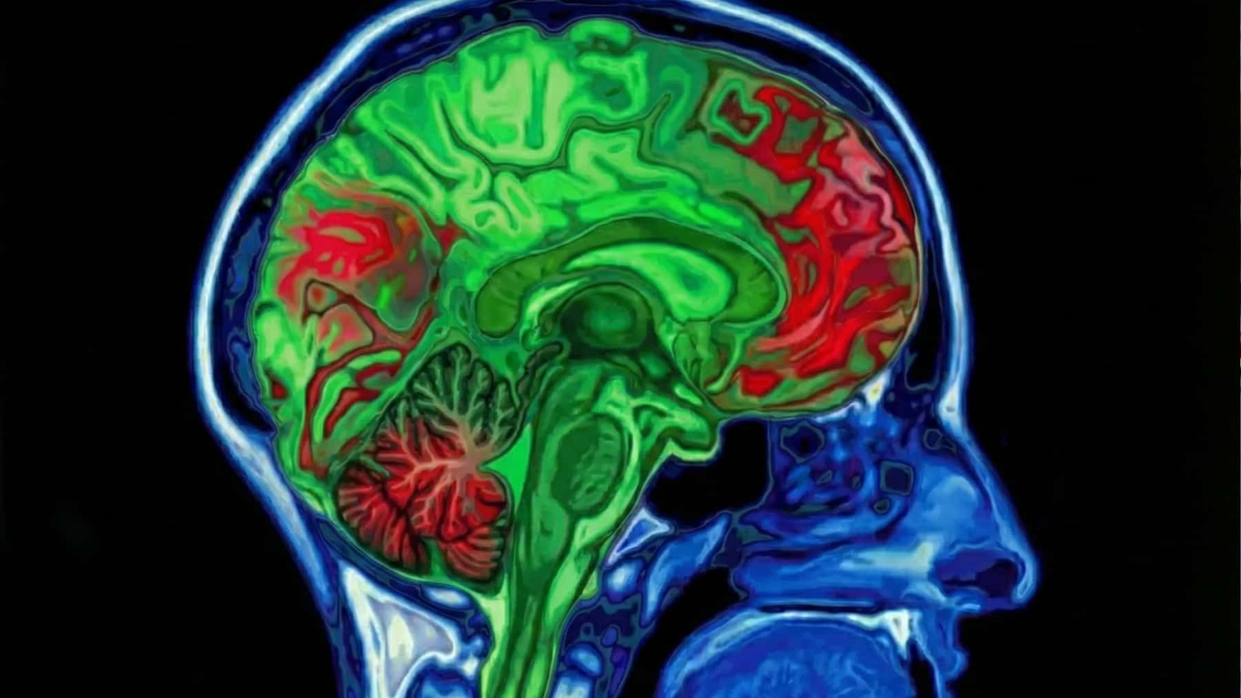 Cerebro en alto contraste