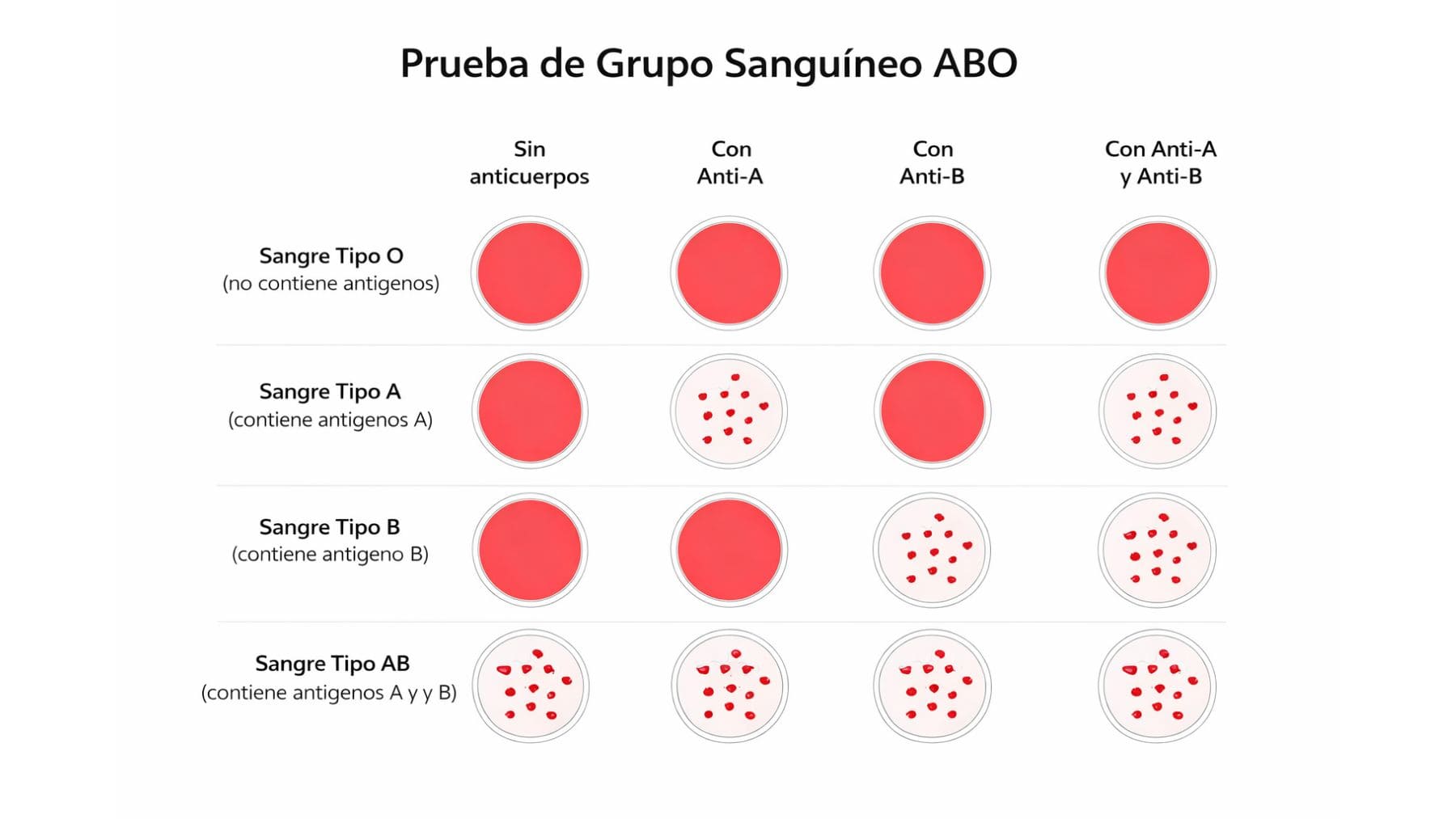 Prueba del grupo sanguíneo ABO que muestra el fenotipo híbrido B(A) con expresión débil del antígeno A.