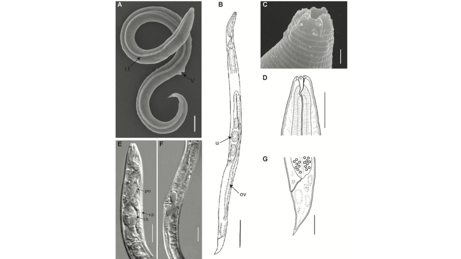 Un gusano microscópico revive tras 46.000 años congelado en Siberia y revela claves genéticas sobre la resistencia extrema.