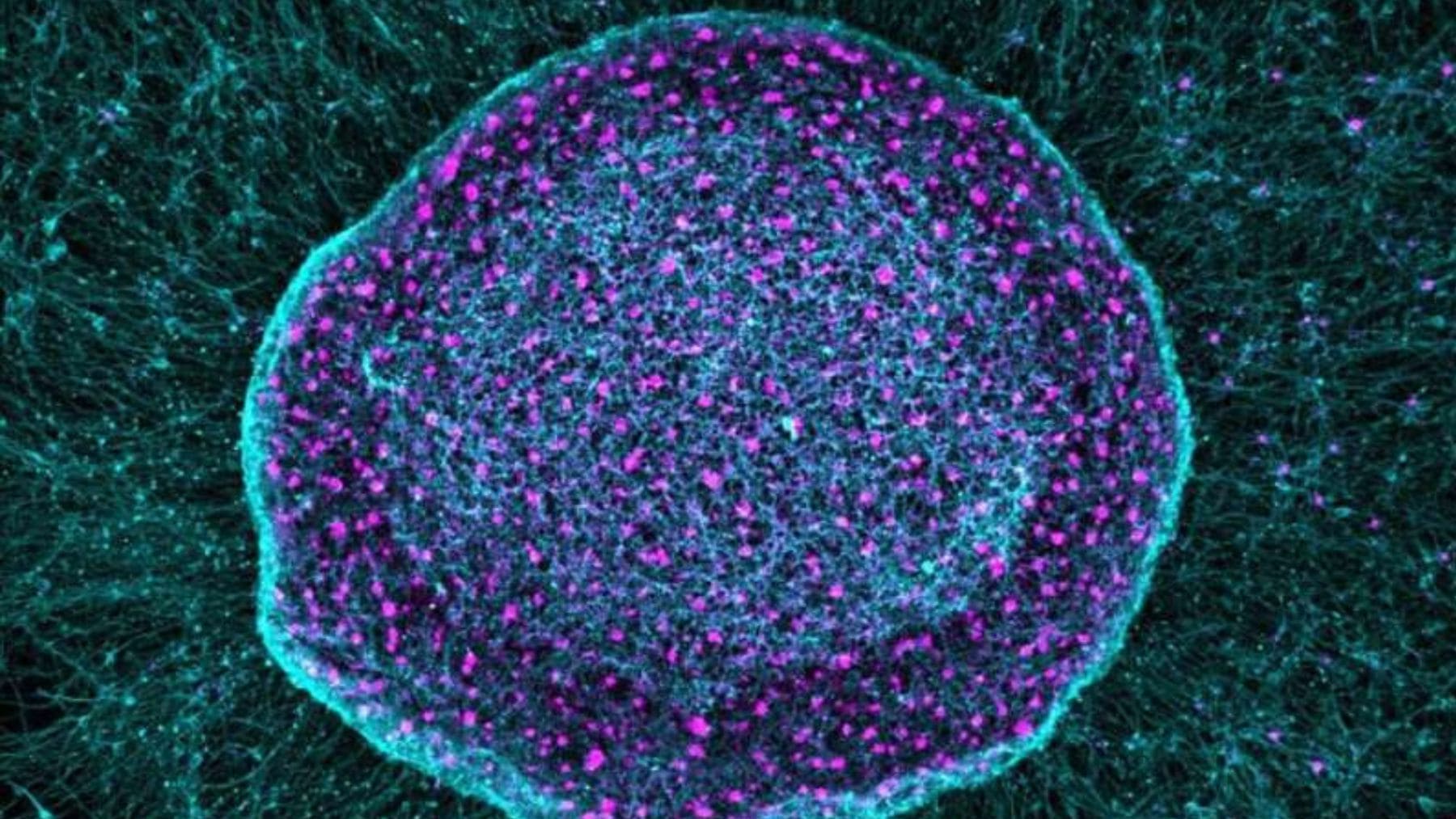 Neuronas creadas a partir de células madre que actúan como una esponja para absorber señales de dolor.