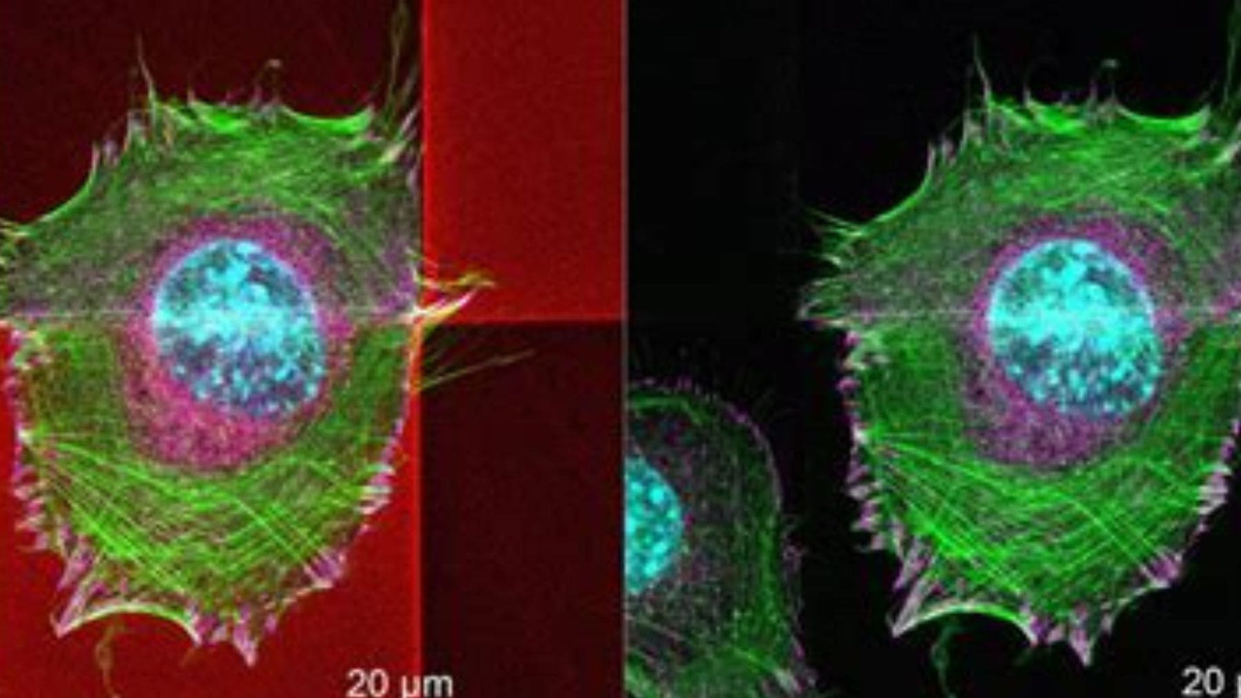 Microestructura tridimensional fabricada dentro de una célula humana viva mediante polimerización por dos fotones.