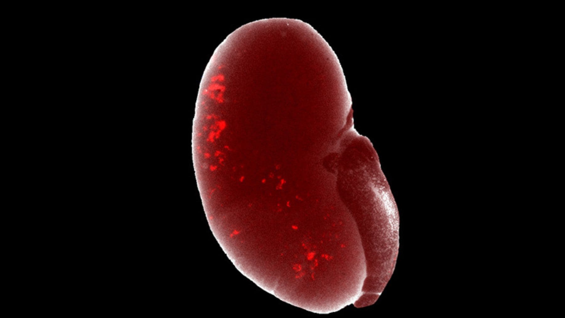 Mini riñón artificial en 3D creado con células madre humanas por científicos de la Universidad del Sur de California.