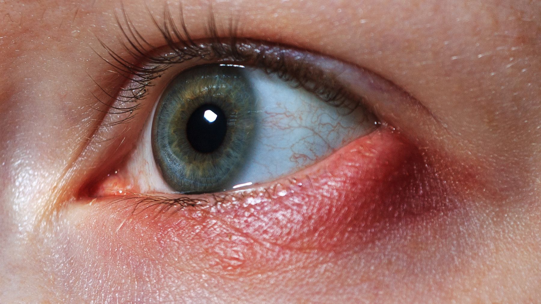 Ojo humano con daño corneal, investigación para regenerar la córnea con escamas de pez.