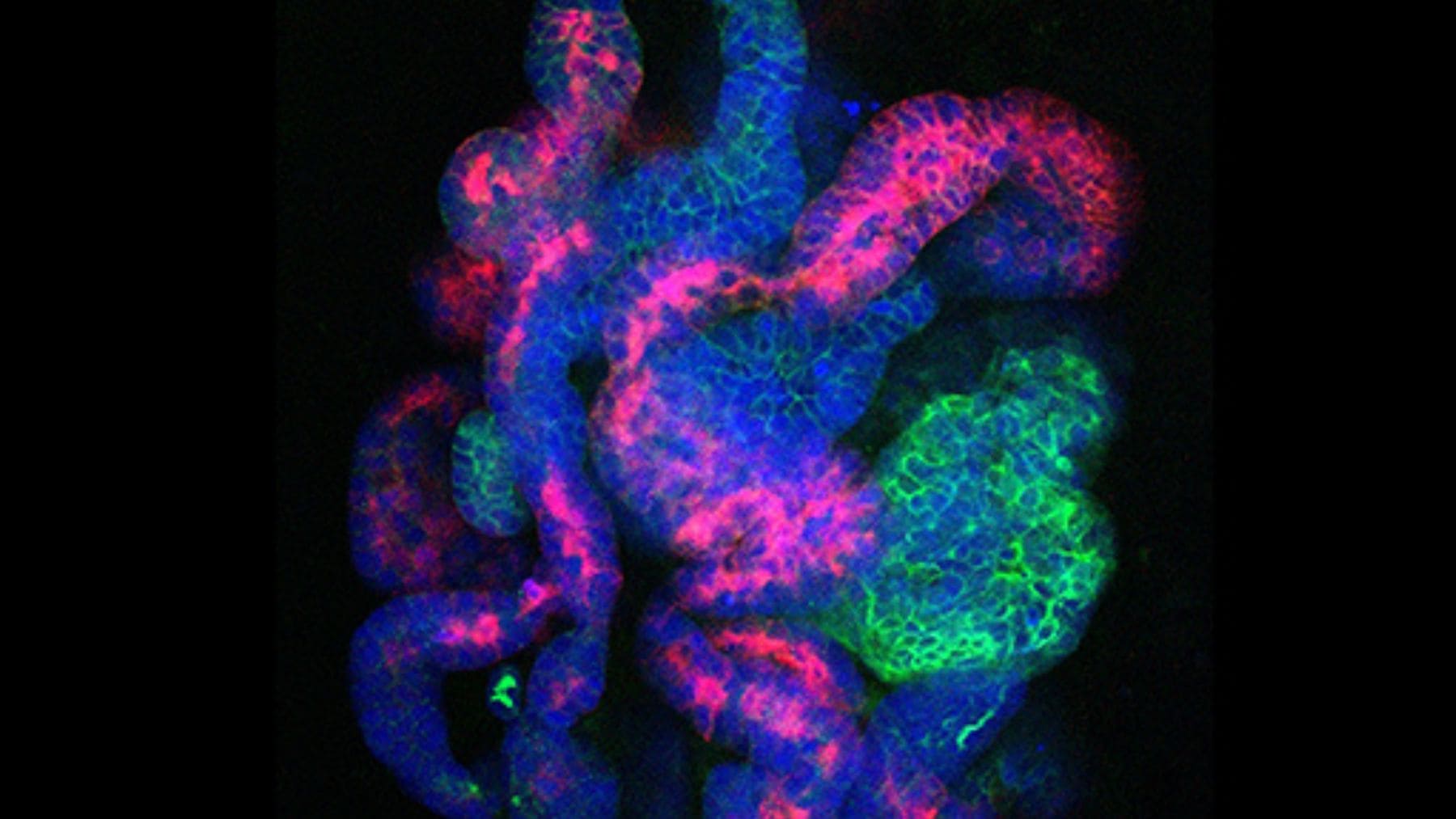 Mini riñón artificial en 3D creado por la Universidad del Sur de California a partir de células humanas.