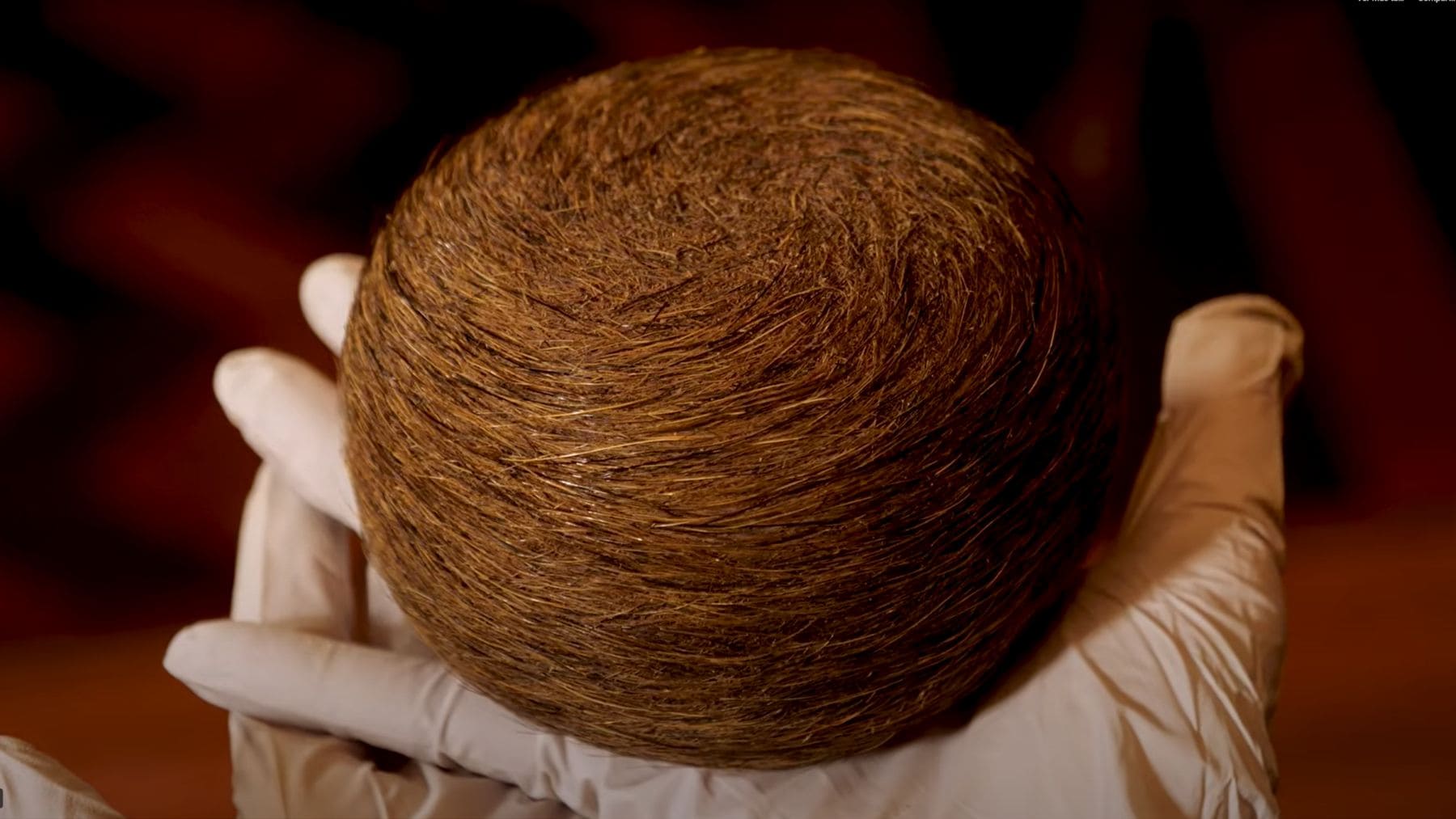 Piedra bezoar encontrada en el estómago de un corzo en España sostenida en la mano.