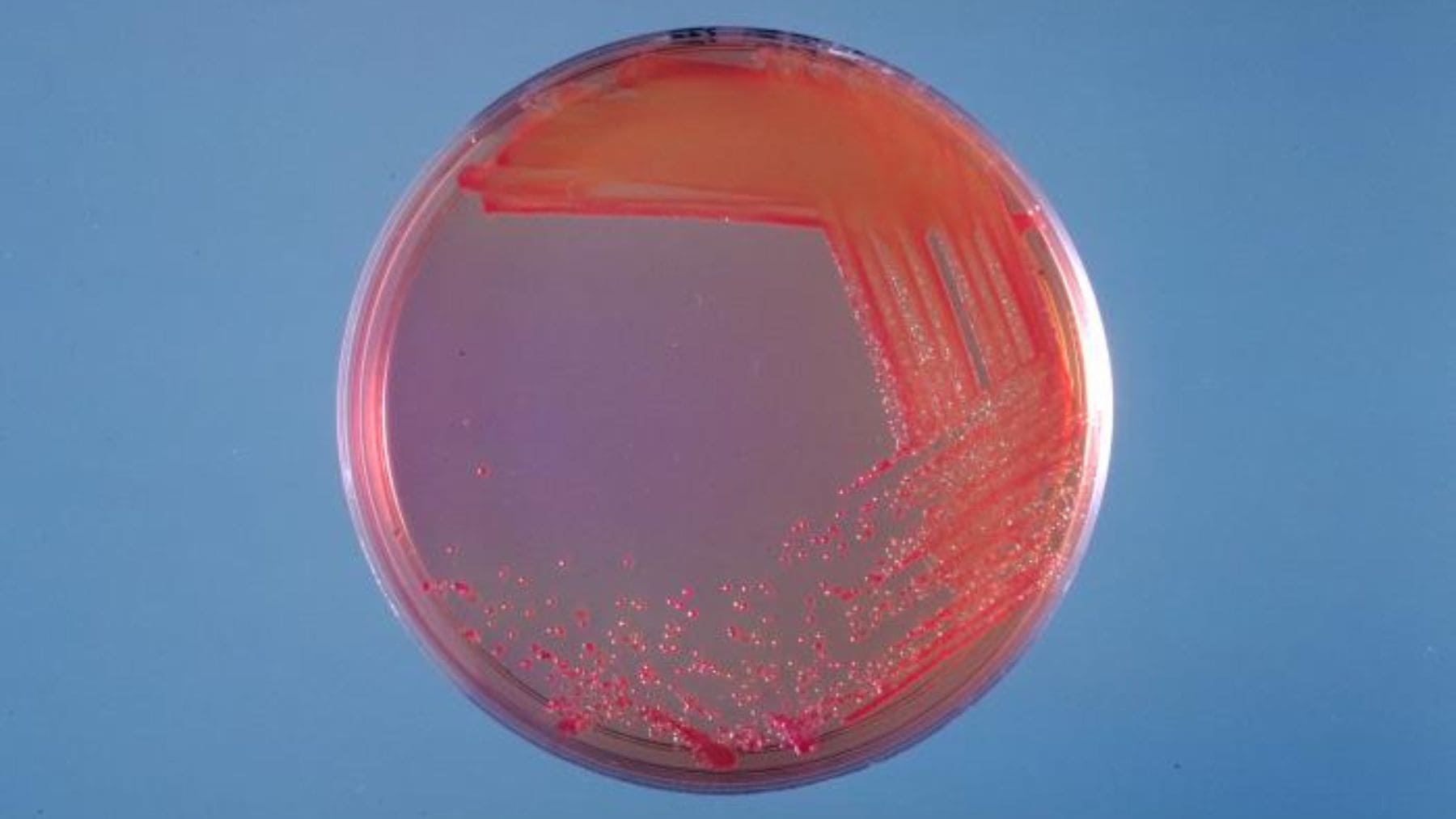 Placa de Petri con bacterias resistentes a antibióticos tras exposición a desinfectantes en laboratorio.