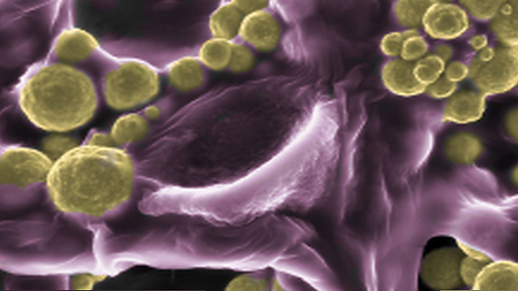 Hongo Fusarium oxysporum con nanopartículas de oro adheridas observado con microscopía en Australia.
