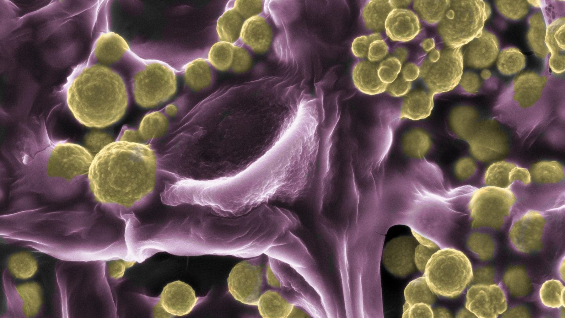 Imagen microscópica de un hongo Fusarium oxysporum cubierto de partículas microscópicas de oro