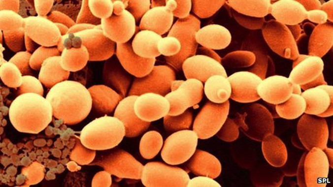 Reconstrucción de la historia filogenética de la fosforilación de proteínas de 18 especies de hongos