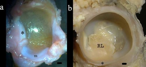 Descubren un menisco en la cadera de los anfibios