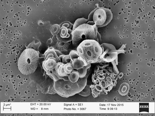El porqué del auge de las algas microscópicas