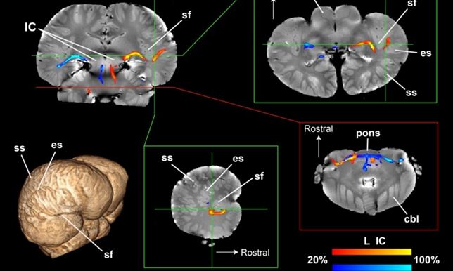 Los delfines ven con los oídos