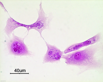 Jornada sobre biomateriales y el entorno celular en Ávila