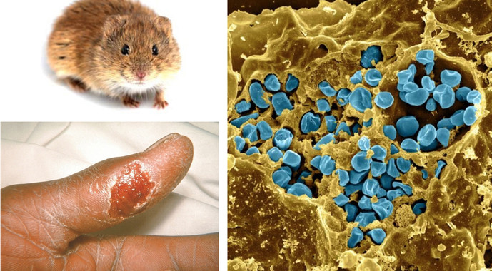 La ‘tularemia’ y la plaga de los topillos