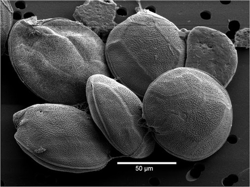 Hallan una nueva especie de microalga tóxica causante de ciguatera