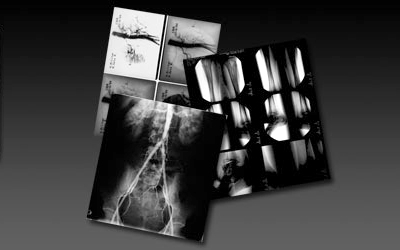 Las farmacias murcianas inician campaña medioambiental y solidaria de recogida de radiografías para ayudar Tercer Mundo