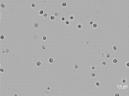Nueva Microalga Nannochloris para obtener biodiesel