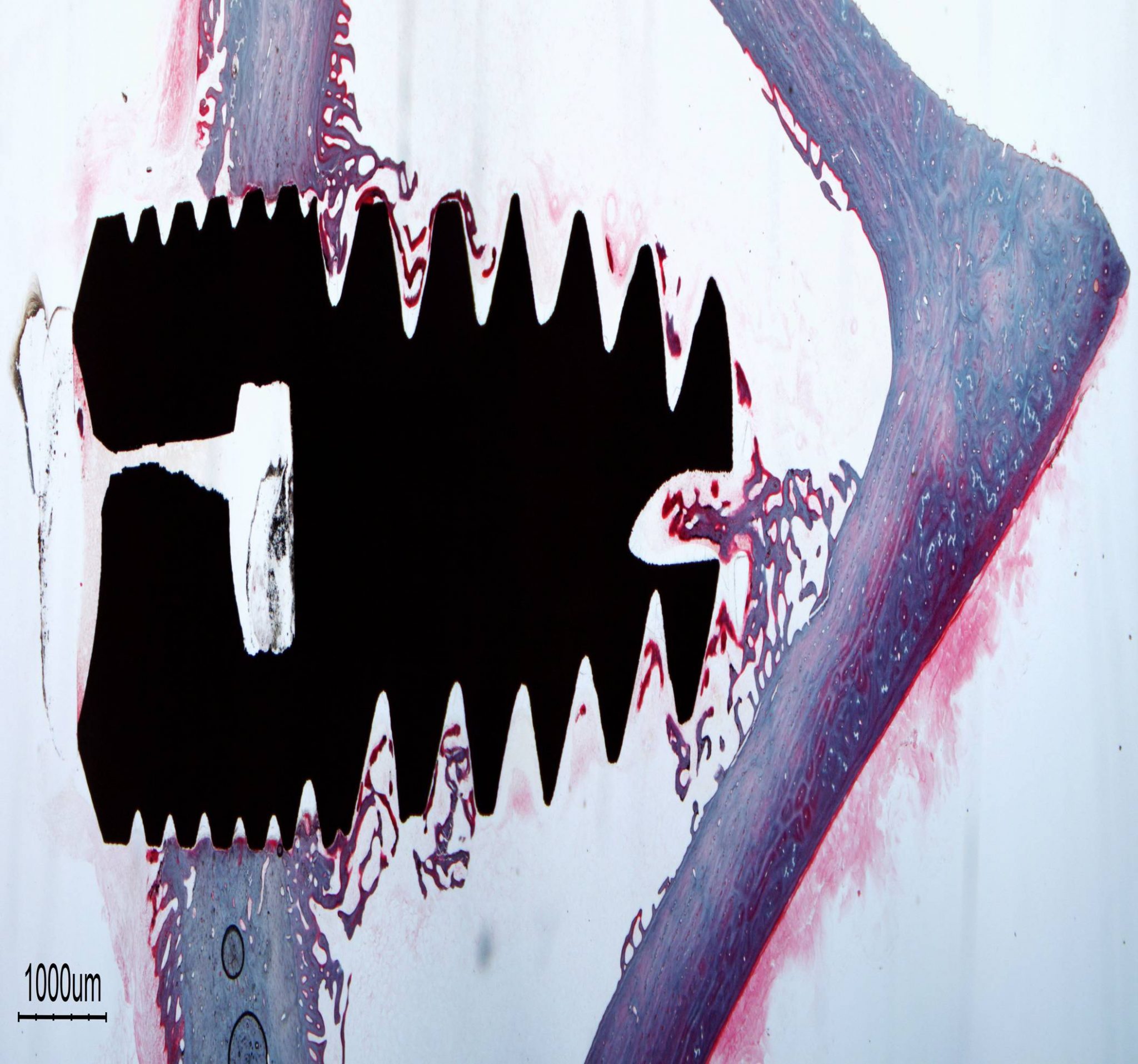 Innovador recubrimiento biodegradable para los implantes dentales