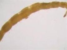 Una larva de Ecuador