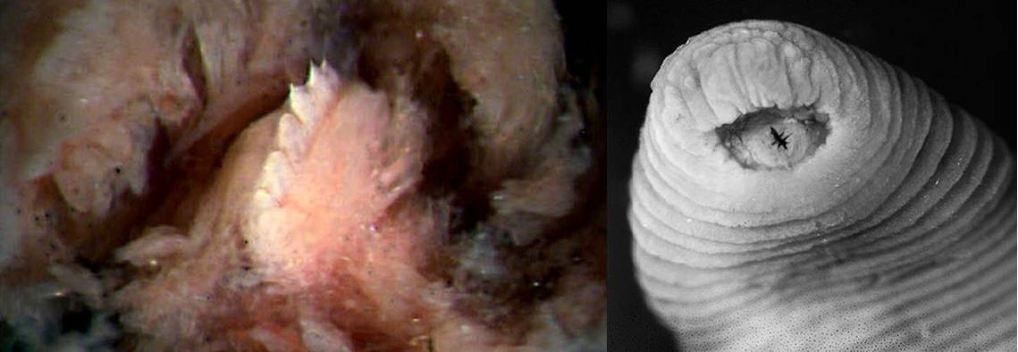 Una sanguijuela con dientes