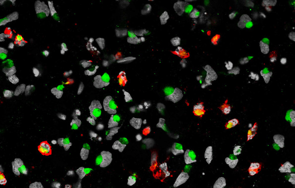El Zika ‘ataca’ a las células madre neurales