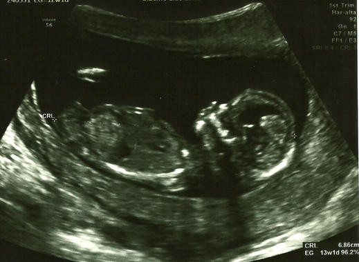 Los contaminantes ambientales afectan notablemente a la fertilidad