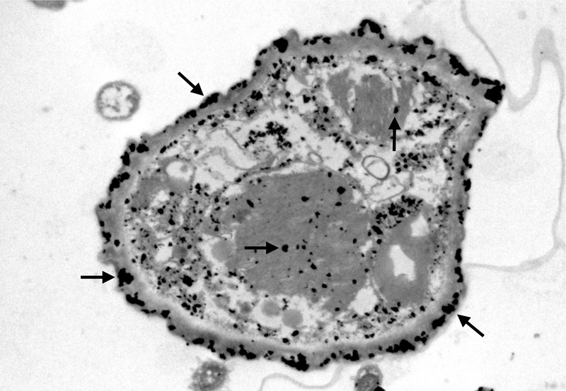 Métodos de microscopia de elevada resolución mejoran el estudio de la toxicidad de los metales en microorganismos de sedimentos marinos