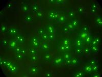 Protozoos parásitos sobreviven a las depuradoras y potabilizadoras gallegas