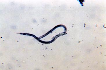 Nuevos nematodos presentes en aguas depuradas