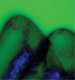 Los microplásticos ‘asesinos’ que se filtran a la fauna marina a través de las branquias