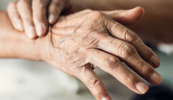 El baile del pasodoble como estrategia para mejorar la calidad de vida de los enfermos de párkinson y de sus cuidadores