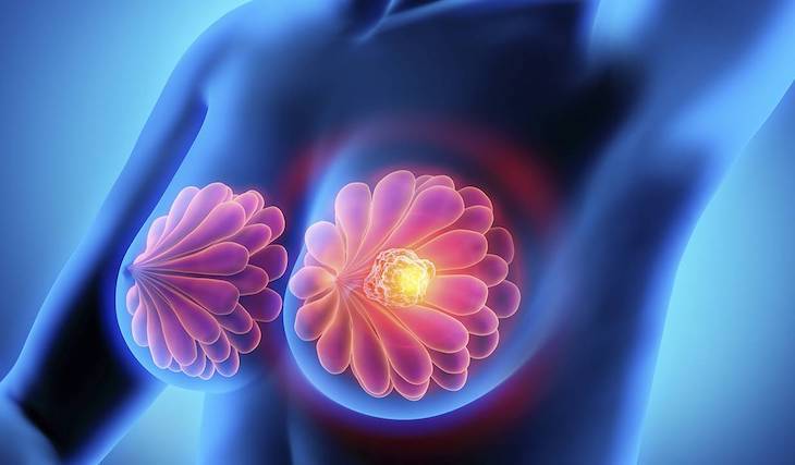 Las mujeres que trabajan al aire libre tienen un menor riesgo de cáncer de mama