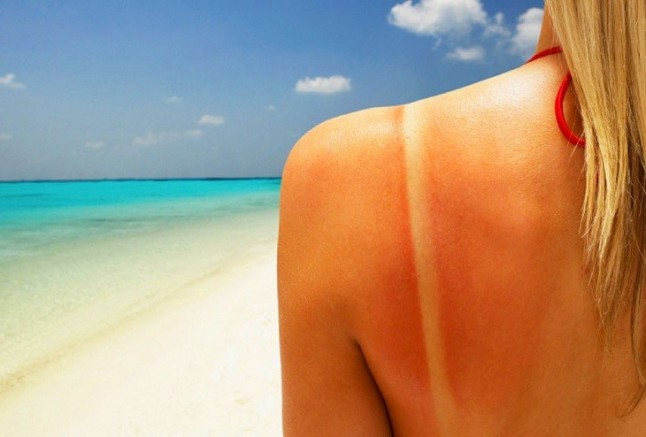 No existe el bronceado saludable