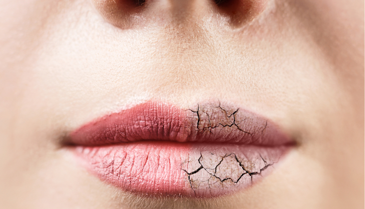 Para evitar la sequedad en la boca